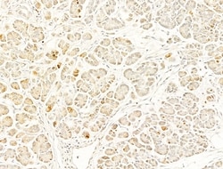 Invitrogen Phospho-AKT1/AKT2/AKT3 (Thr308) Polyclonal Antibody 100 &mu;L;