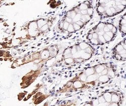 Invitrogen Phospho-AKT1/AKT2/AKT3 (Thr308) Polyclonal Antibody 100 &mu;L;