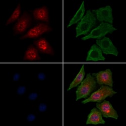 Invitrogen Phospho-AKT2 (Ser474) Polyclonal Antibody 100 &mu;L | Buy Online | Invitrogen&trade; | Fisher Scientific