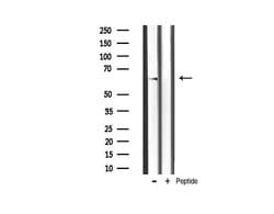Invitrogen Phospho-AKT2 (Ser474) Polyclonal Antibody 100 &mu;L | Buy Online | Invitrogen&trade; | Fisher Scientific