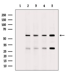 Phospho-beta Catenin (Ser33) Polyclonal Antibody:Antibodies, Polyclonal
