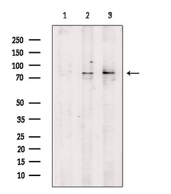 Phospho-beta Catenin (Ser33) Polyclonal Antibody:Antibodies, Polyclonal