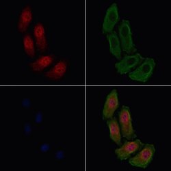 Phospho-beta Catenin (Ser33) Polyclonal Antibody:Antibodies, Polyclonal