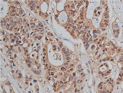 Phospho-beta Catenin (Ser33) Polyclonal Antibody:Antibodies, Polyclonal