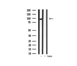 Phospho-beta Catenin (Ser33) Polyclonal Antibody:Antibodies, Polyclonal