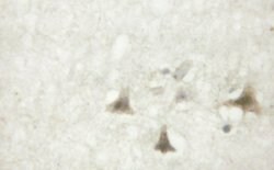 Invitrogen Phospho-beta Catenin (Tyr489) Polyclonal Antibody 100 &mu;L;