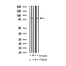 Invitrogen Phospho-beta Catenin (Tyr489) Polyclonal Antibody 100 &mu;L;