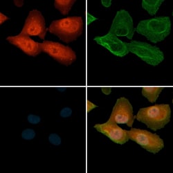 Invitrogen Phospho-NF2 (Ser518) Polyclonal Antibody 100 &mu;L; Unconjugated:Antibodies,