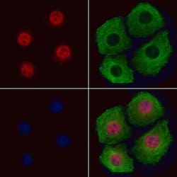 Invitrogen Phospho-IRS1 (Ser636) Polyclonal Antibody 100 &mu;L; Unconjugated:Antibodies,