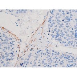 Invitrogen Phospho-IRS1 (Ser636) Polyclonal Antibody 100 &mu;L; Unconjugated:Antibodies,