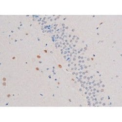 Invitrogen Phospho-IRS1 (Ser636) Polyclonal Antibody 100 &mu;L; Unconjugated:Antibodies,