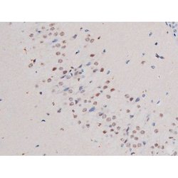 Invitrogen Phospho-IRS1 (Ser636) Polyclonal Antibody 100 &mu;L; Unconjugated:Antibodies,