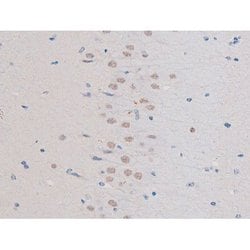 Invitrogen Phospho-IRS1 (Ser636) Polyclonal Antibody 100 &mu;L; Unconjugated:Antibodies,