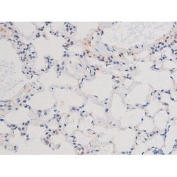 Invitrogen Phospho-IRS1 (Ser636) Polyclonal Antibody 100 &mu;L; Unconjugated:Antibodies,