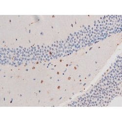 Invitrogen Phospho-IRS1 (Ser636) Polyclonal Antibody 100 &mu;L; Unconjugated:Antibodies,