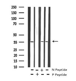 Invitrogen Phospho-IRS1 (Ser636) Polyclonal Antibody 100 &mu;L; Unconjugated:Antibodies,