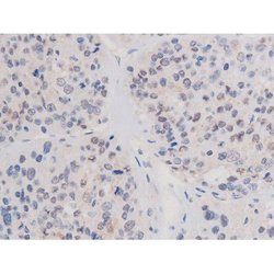 Phospho-alpha Adducin (Ser726) Polyclonal Antibody, Invitrogen 100 &mu;L;