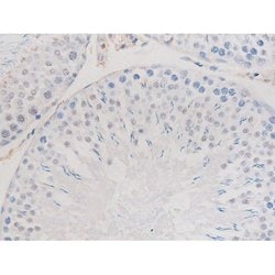 Phospho-alpha Adducin (Ser726) Polyclonal Antibody, Invitrogen 100 &mu;L;