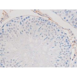 Phospho-alpha Adducin (Ser726) Polyclonal Antibody, Invitrogen 100 &mu;L;
