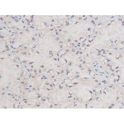 Phospho-alpha Adducin (Ser726) Polyclonal Antibody, Invitrogen 100 &mu;L;
