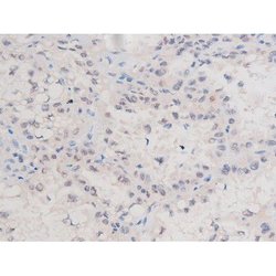 Phospho-alpha Adducin (Ser726) Polyclonal Antibody, Invitrogen 100 &mu;L;