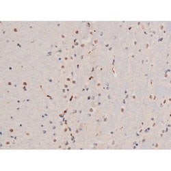 Phospho-alpha Adducin (Ser726) Polyclonal Antibody, Invitrogen 100 &mu;L;