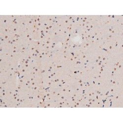Phospho-alpha Adducin (Ser726) Polyclonal Antibody, Invitrogen 100 &mu;L;
