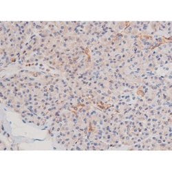 Phospho-alpha Adducin (Ser726) Polyclonal Antibody, Invitrogen 100 &mu;L;