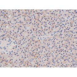 Phospho-alpha Adducin (Ser726) Polyclonal Antibody, Invitrogen 100 &mu;L;
