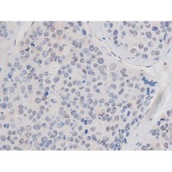 Phospho-alpha Adducin (Ser726) Polyclonal Antibody, Invitrogen 100 &mu;L;