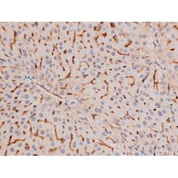 Phospho-alpha Adducin (Ser726) Polyclonal Antibody, Invitrogen 100 &mu;L;