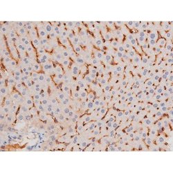 Phospho-alpha Adducin (Ser726) Polyclonal Antibody, Invitrogen 100 &mu;L;