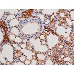 Phospho-alpha Adducin (Ser726) Polyclonal Antibody, Invitrogen 100 &mu;L;