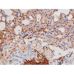 Phospho-alpha Adducin (Ser726) Polyclonal Antibody, Invitrogen 100 &mu;L;
