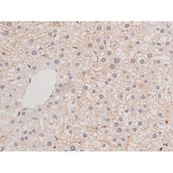 Phospho-alpha Adducin (Ser726) Polyclonal Antibody, Invitrogen 100 &mu;L;