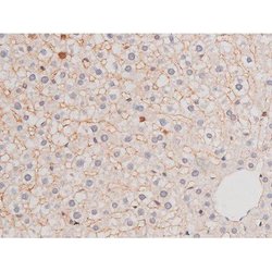 Phospho-alpha Adducin (Ser726) Polyclonal Antibody, Invitrogen 100 &mu;L;