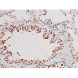 Phospho-alpha Adducin (Ser726) Polyclonal Antibody, Invitrogen 100 &mu;L;