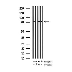 Phospho-alpha Adducin (Ser726) Polyclonal Antibody, Invitrogen 100 &mu;L;