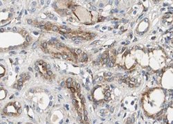 Invitrogen Phospho-VEGF Receptor 2 (Tyr951) Polyclonal Antibody 100 μL;