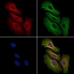 Invitrogen Phospho-MEK2 (Thr394) Polyclonal Antibody 100 &mu;L; Unconjugated:Antibodies,