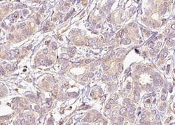 Invitrogen Phospho-MEK2 (Thr394) Polyclonal Antibody 100 &mu;L; Unconjugated:Antibodies,