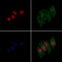 Invitrogen Phospho-PPAR gamma (Ser112) Polyclonal Antibody 100 &mu;L; Unconjugated:Antibodies,