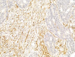 Invitrogen Phospho-PPAR gamma (Ser112) Polyclonal Antibody 100 &mu;L; Unconjugated:Antibodies,