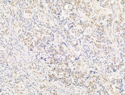 Invitrogen Phospho-PPAR gamma (Ser112) Polyclonal Antibody 100 &mu;L; Unconjugated:Antibodies,