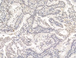 Invitrogen Phospho-PPAR gamma (Ser112) Polyclonal Antibody 100 &mu;L; Unconjugated:Antibodies,