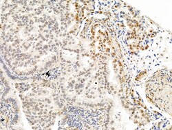 Invitrogen Phospho-PPAR gamma (Ser112) Polyclonal Antibody 100 &mu;L; Unconjugated:Antibodies,
