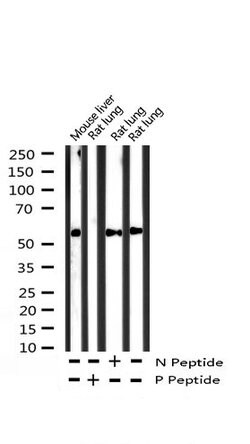 Invitrogen Phospho-PPAR gamma (Ser112) Polyclonal Antibody 100 &mu;L; Unconjugated:Antibodies,