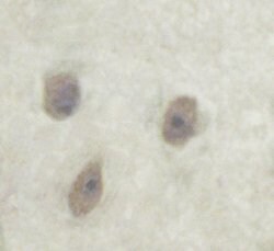 Invitrogen Phospho-Alpha-synuclein (Ser129) Polyclonal Antibody 100 &mu;L;
