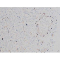 Invitrogen Phospho-Alpha-synuclein (Ser129) Polyclonal Antibody 100 &mu;L;