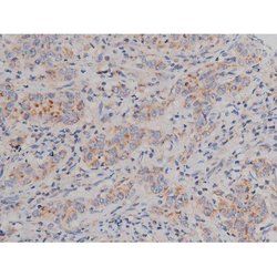 Invitrogen Phospho-Alpha-synuclein (Ser129) Polyclonal Antibody 100 &mu;L;